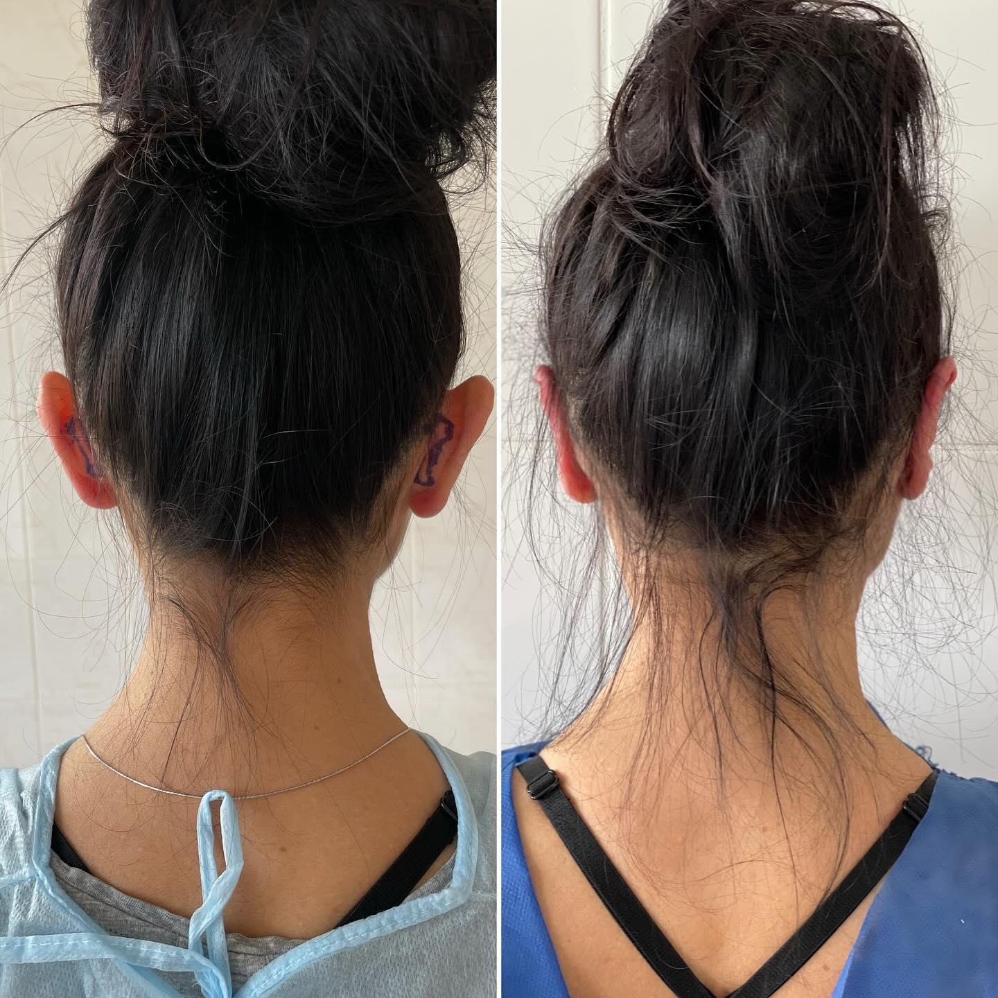 otoplastika kiev